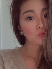 りんな