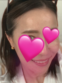 あこ