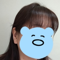 あこ